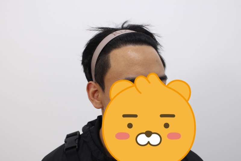수술후오른쪽.jpg