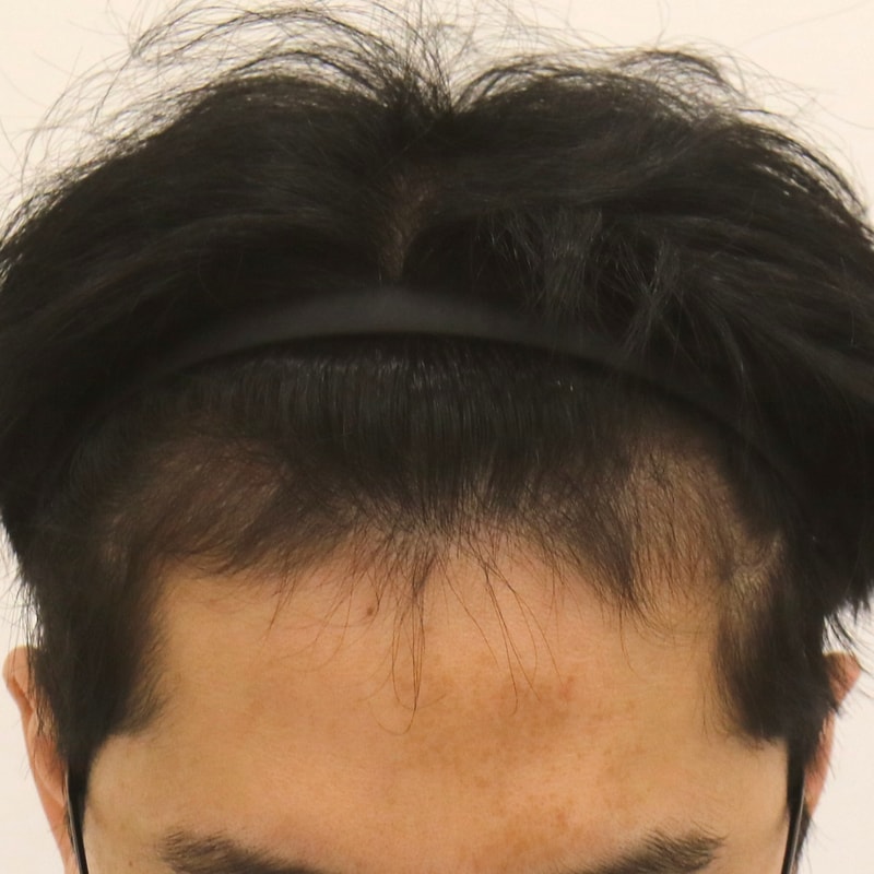 수술전.jpg