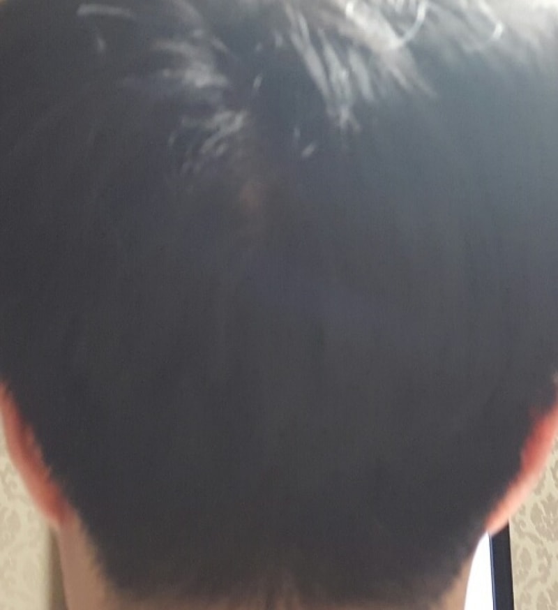 뒤.jpg