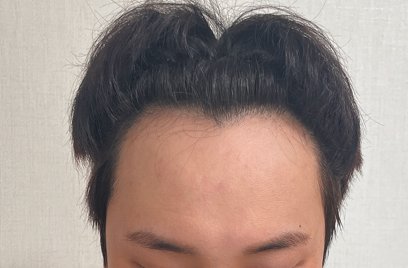 14일차_전03.jpg