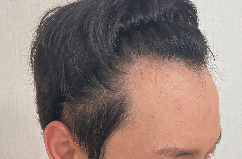 14일차_전01.jpg
