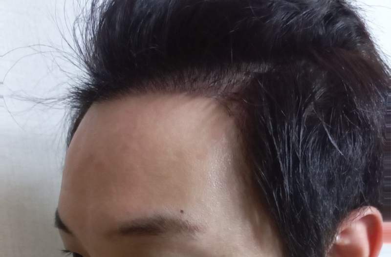 14일차_후02.jpg