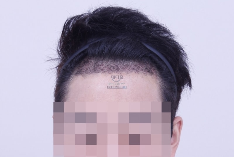 1달1.jpg