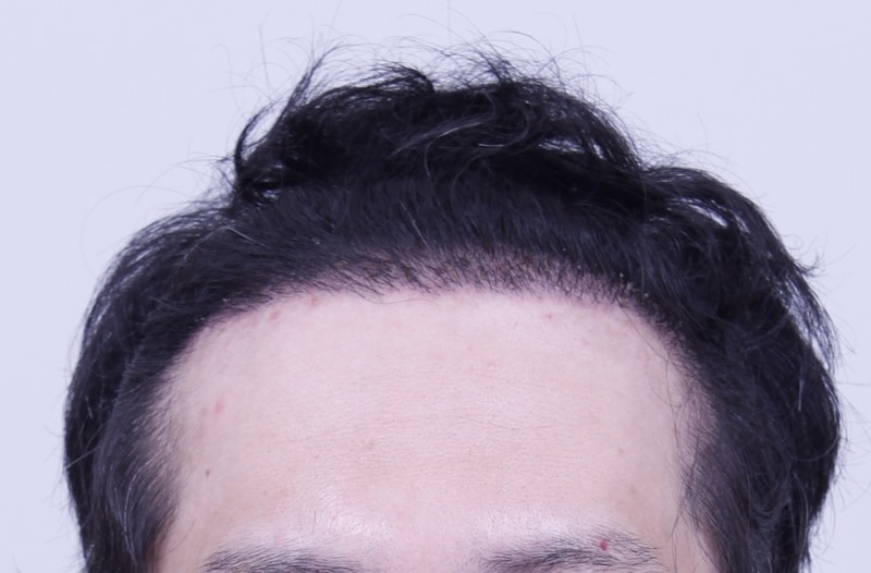 3주1.JPG