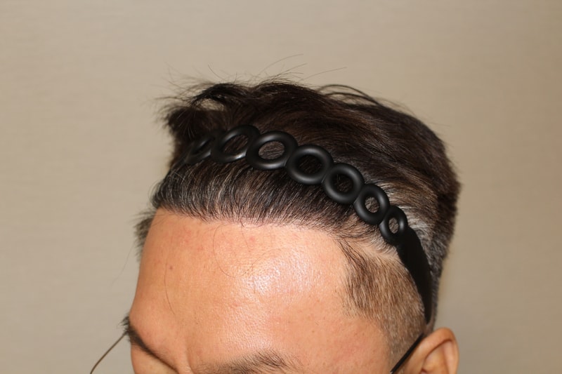 7개월 경과_좌측.jpg