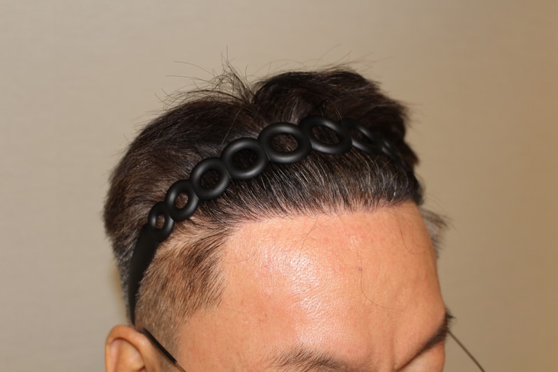7개월 경과_우측.jpg
