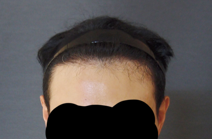 수술후2.jpg