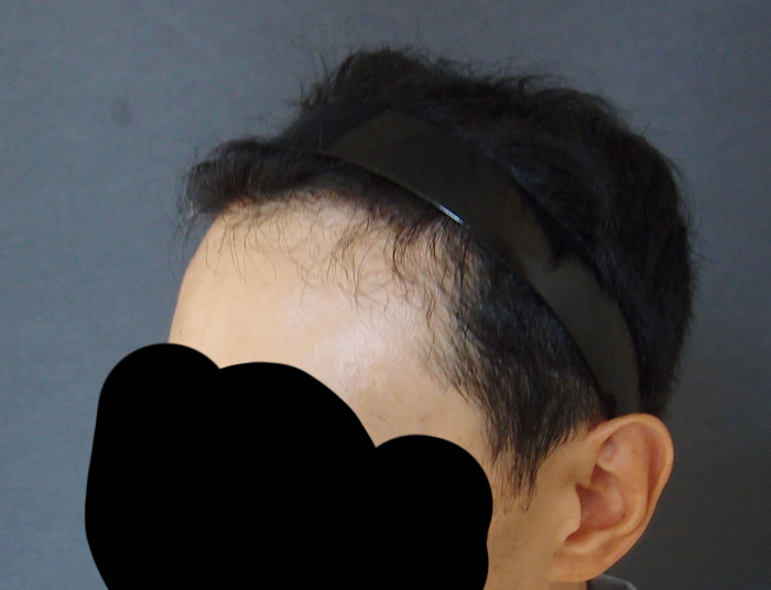 수술후3.jpg