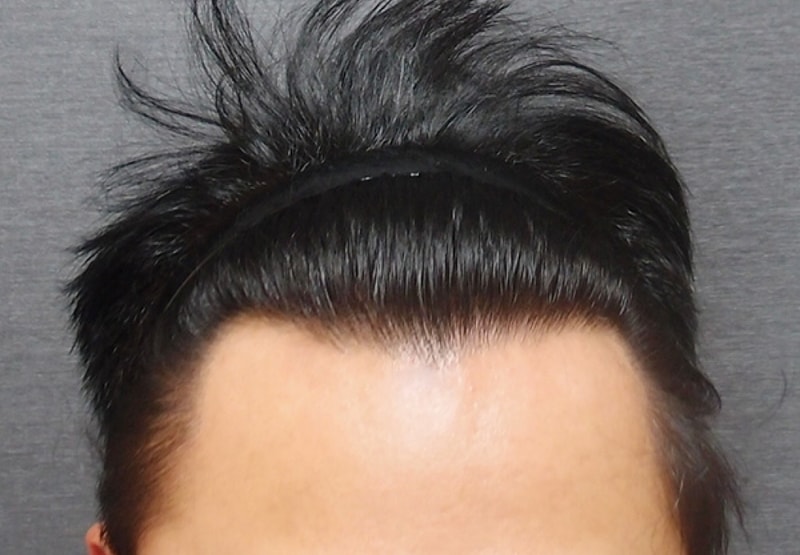 수술후2.jpg