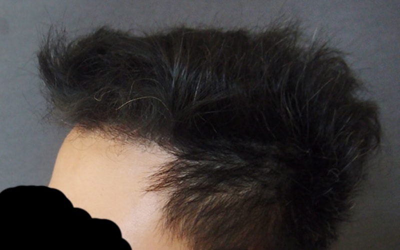 수술후3.jpg