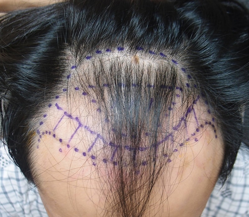 수술전02.jpg