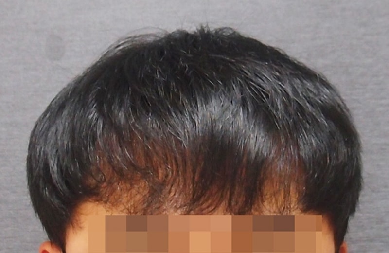 수술후1.jpg