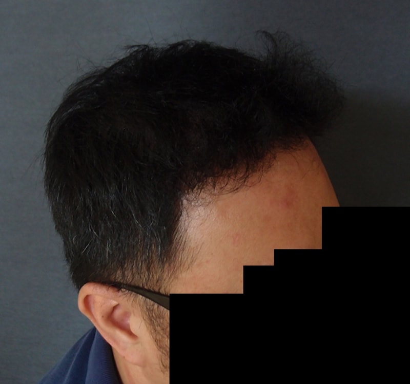 수술후-3.jpg