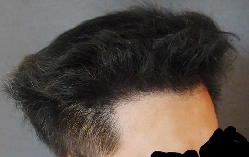 수술후2.jpg