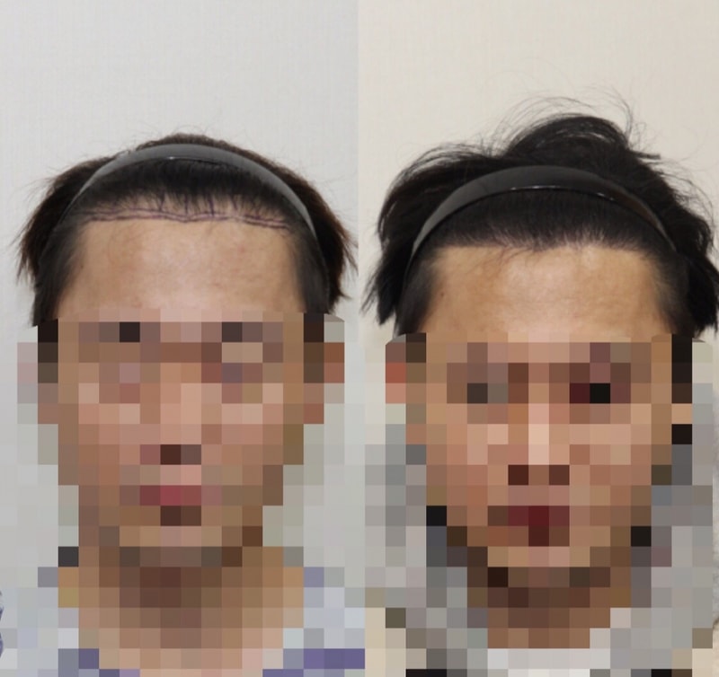 6개월 경과