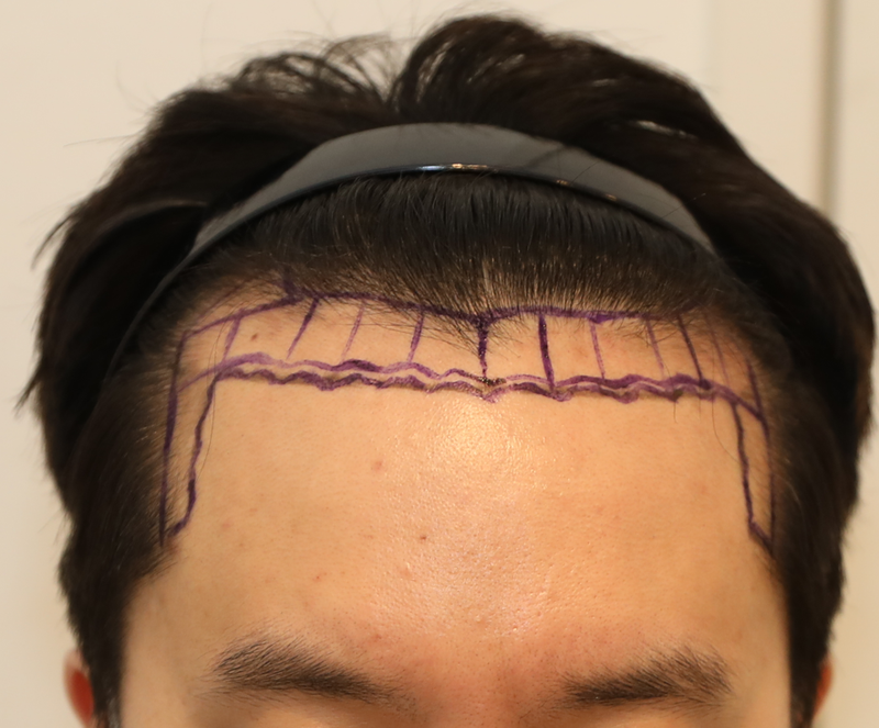 전캡5.png