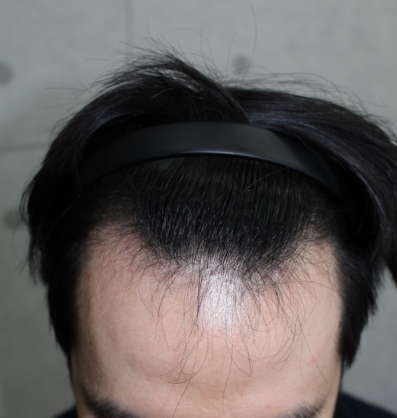 수술전4.JPG