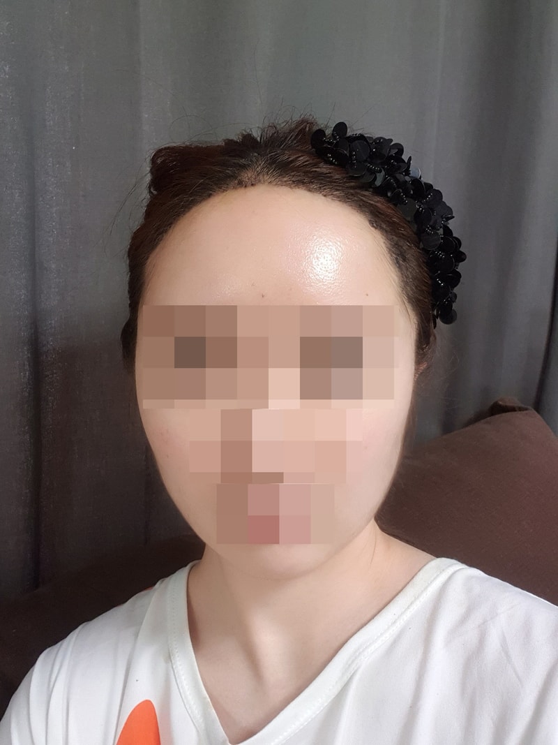 [꾸미기]안수지_정면_후.jpg