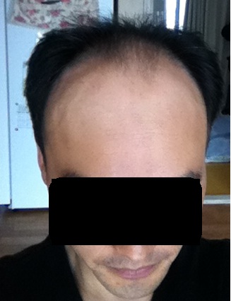 수술 전 평상시.jpg