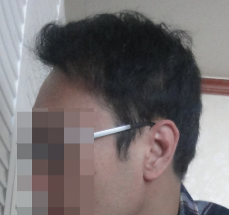 후1년.jpg