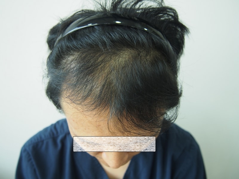 수술전(정면).jpg