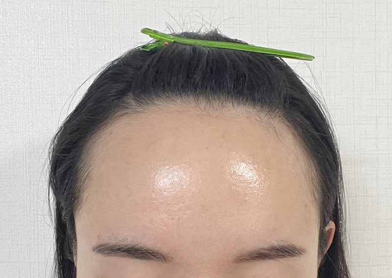 비포 2.jpg