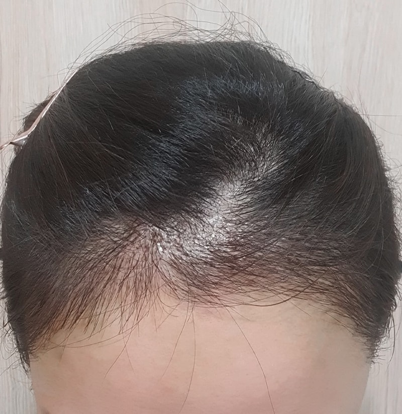 후2.jpg