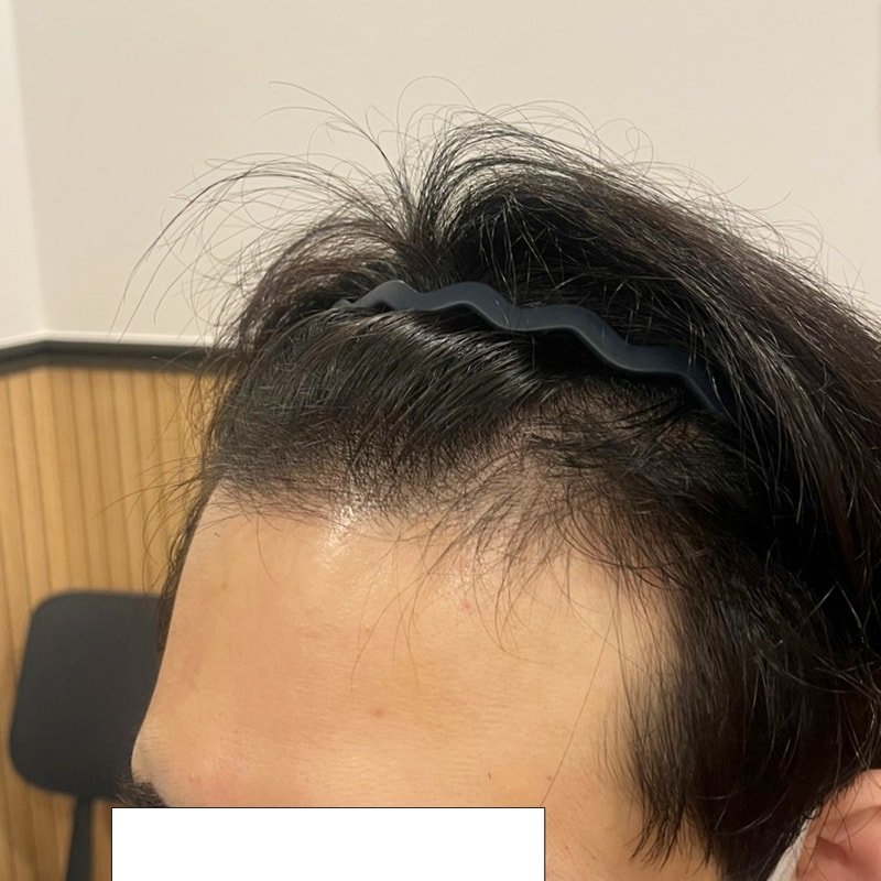 비포 1.jpg