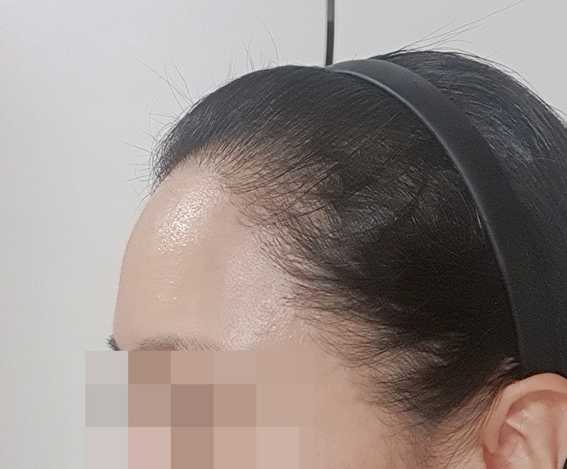 후 4.jpg