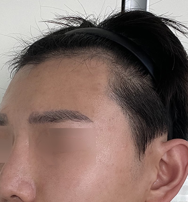 이마반4_1.jpg