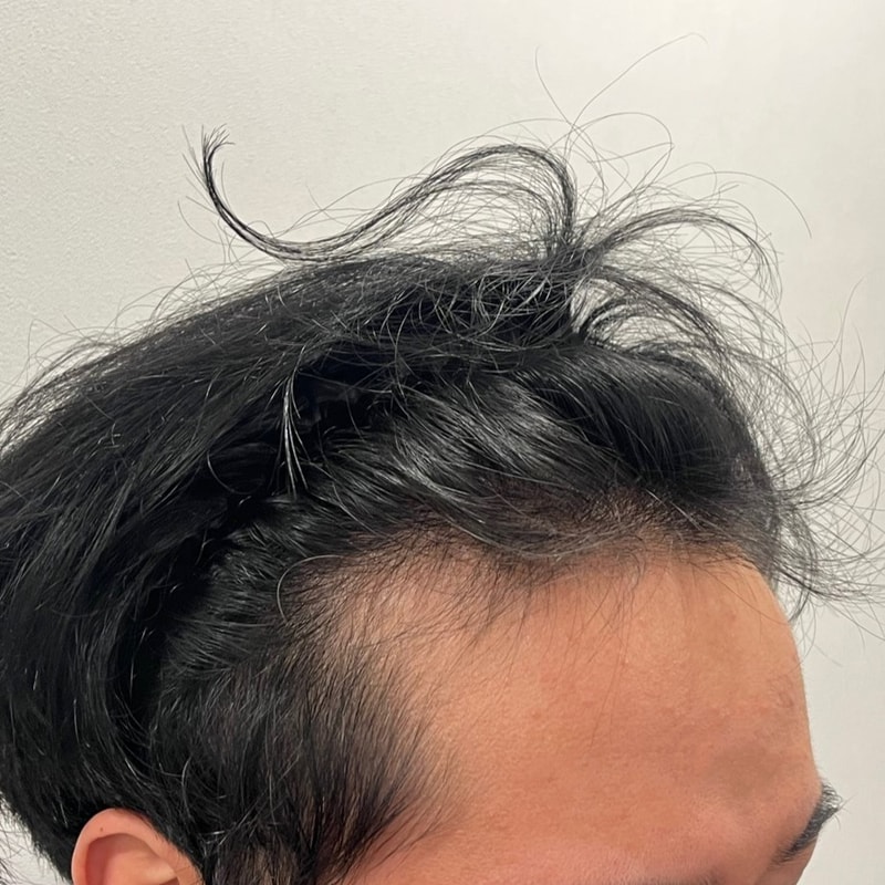 비포 1.jpg