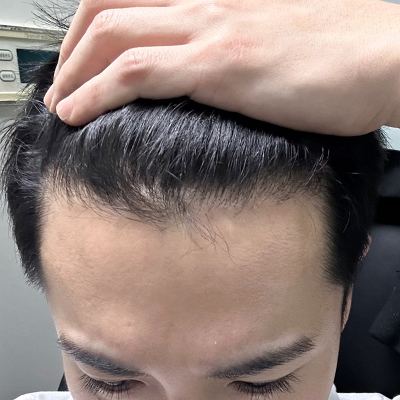후1.jpg