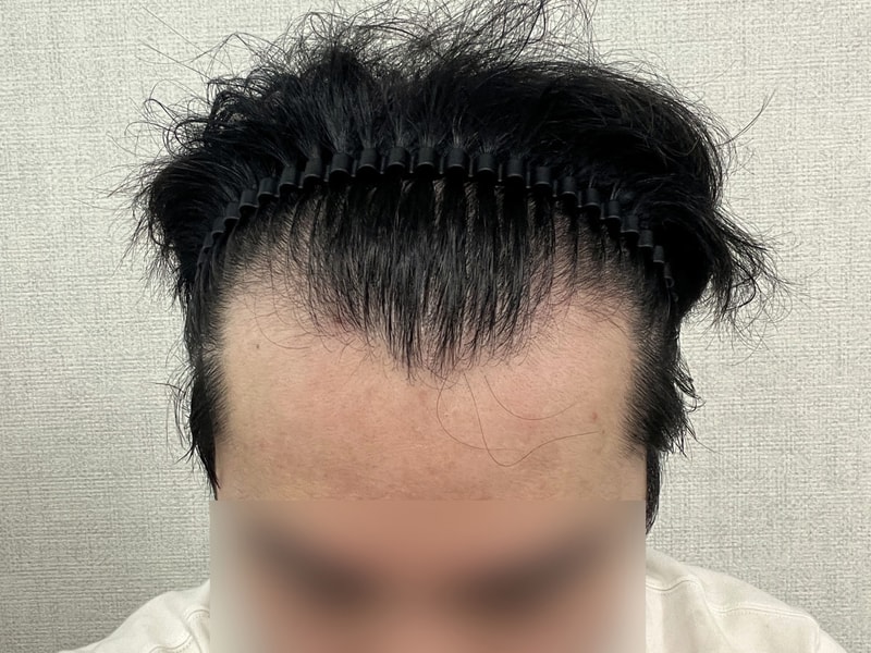 비포 1.jpg