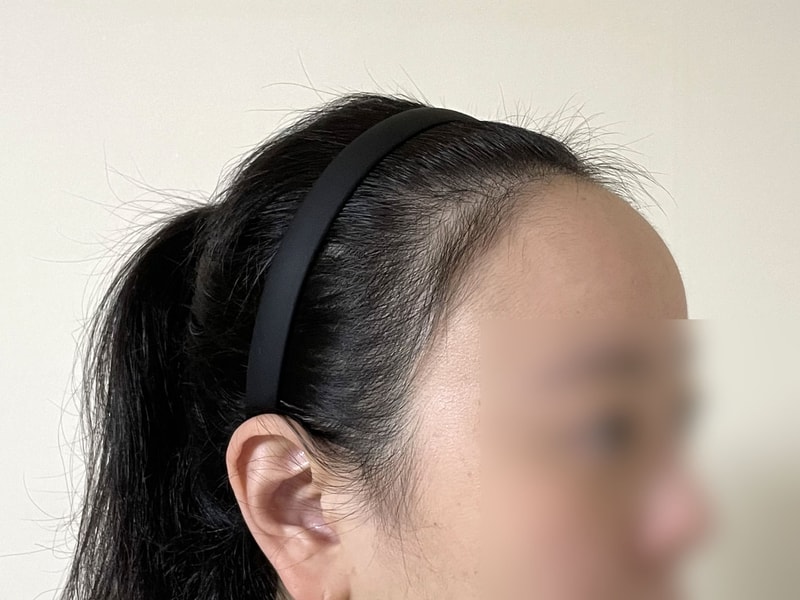 비포 2.jpg