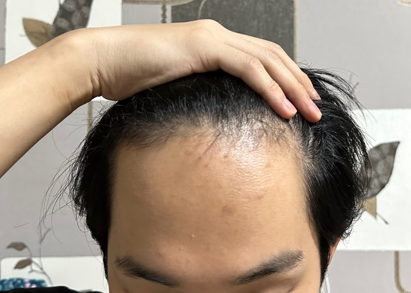 비포 1.jpg