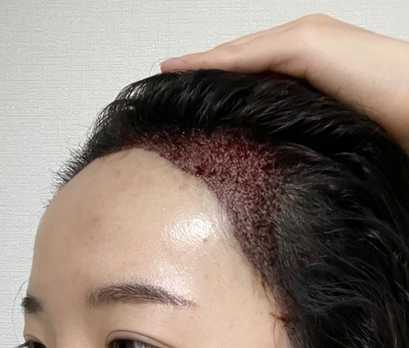 후1.jpg