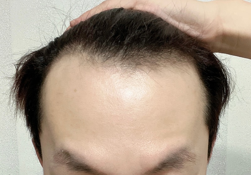 KakaoTalk_20220804_195617601_02.jpg