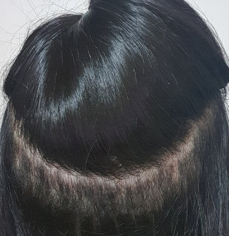 후3.jpg
