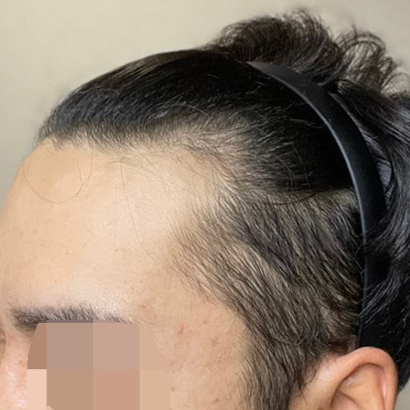 비포 1.jpg