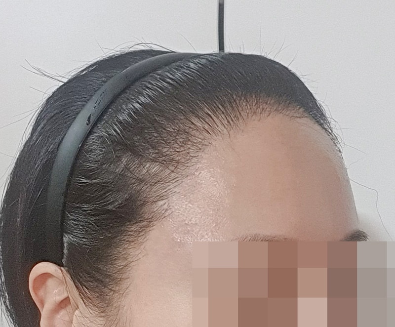 후 5.jpg