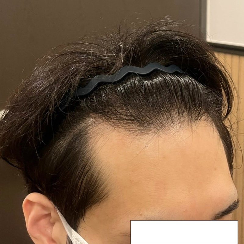 비포 2.jpg