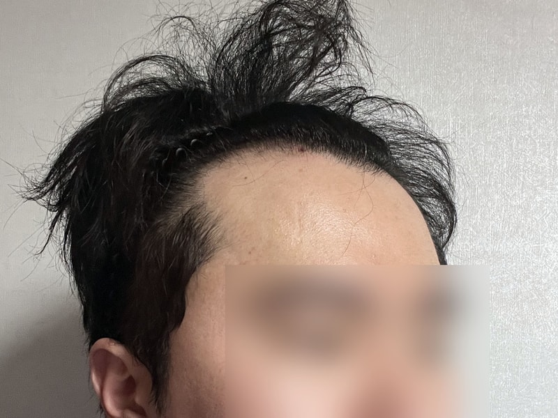 비포 2.jpg