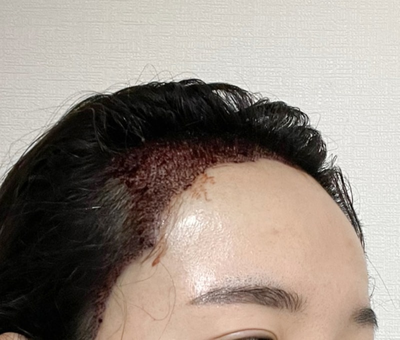 후2.jpg