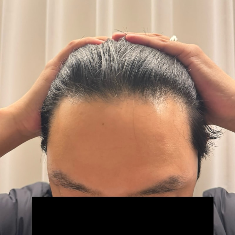 비포 2.jpg
