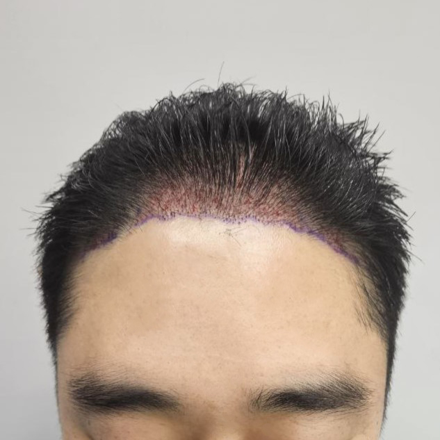후 4.jpg