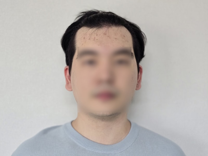 비포 1.jpg