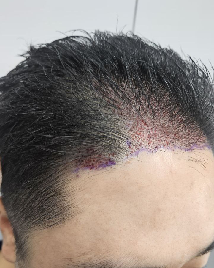 후 1.jpg