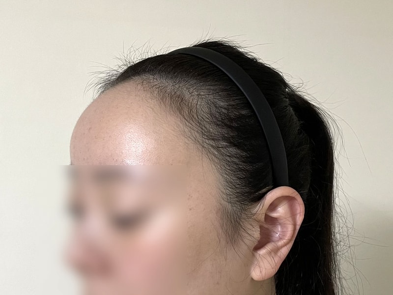 비포 3.jpg