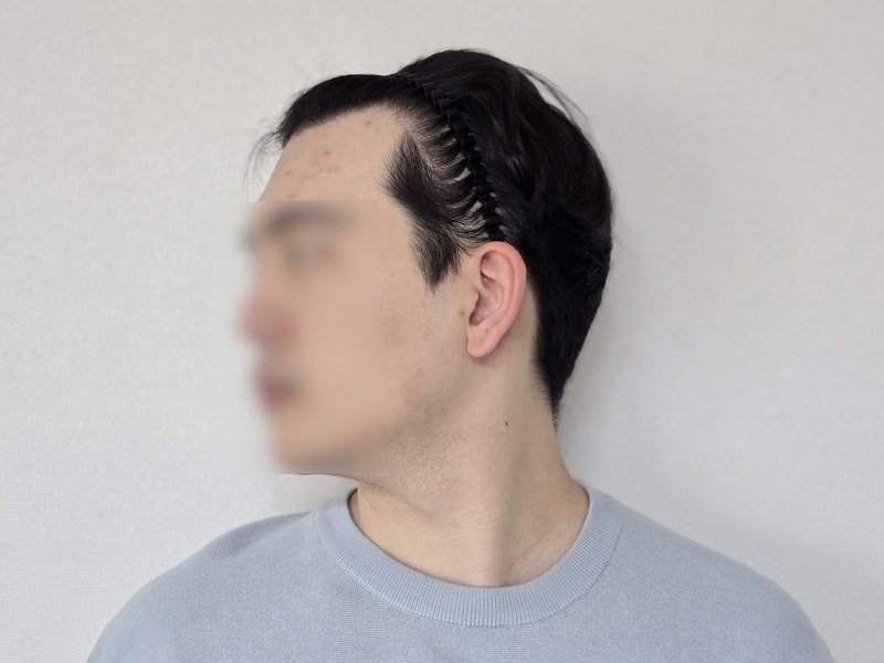 비포 2.jpg