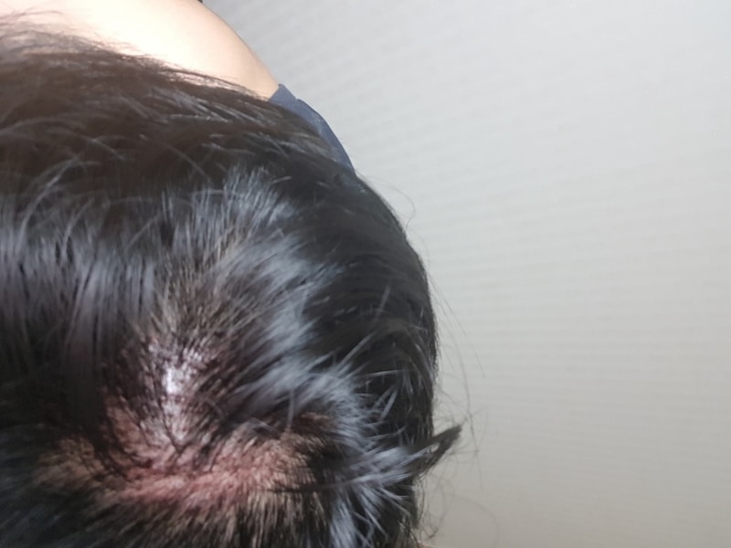 20181128_054444.jpg